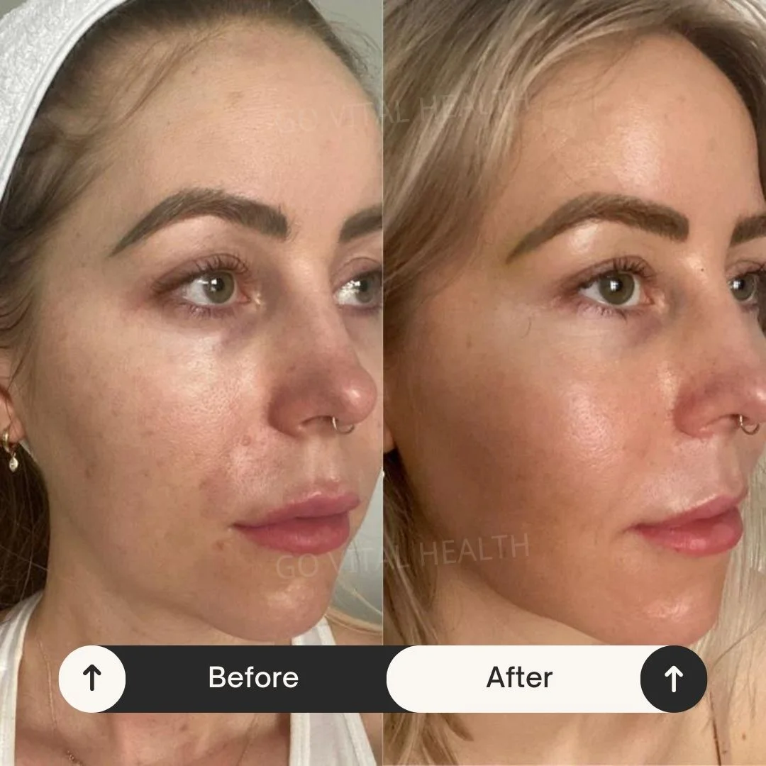 liveon testimonial before and after