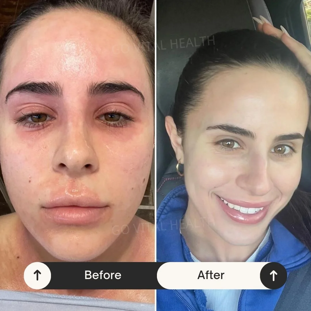 liveon testimonial before and after