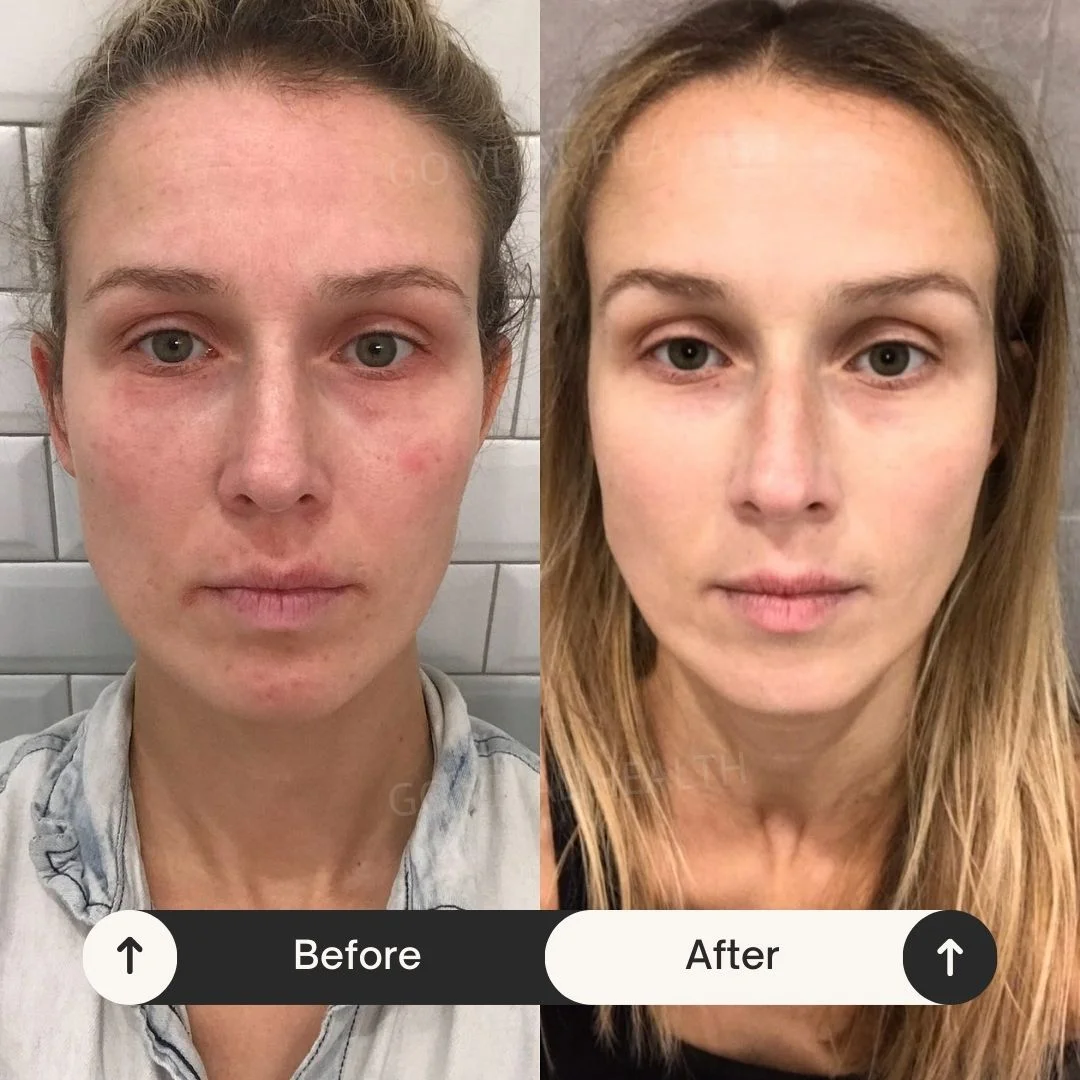 liveon testimonial before and after