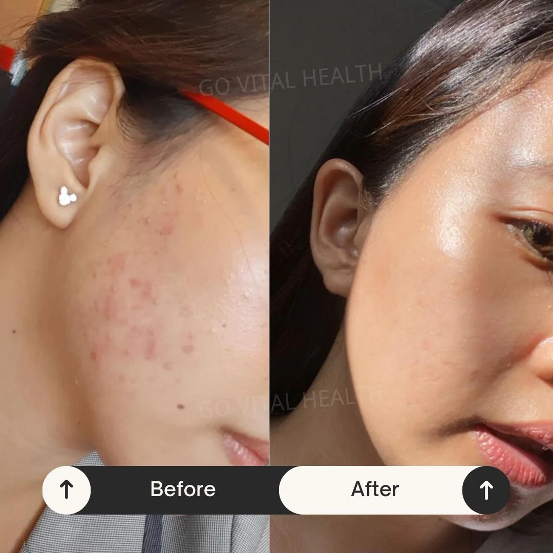 liveon testimonial before and after