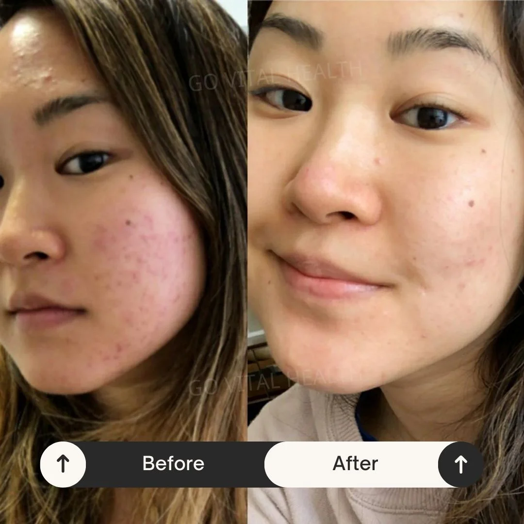 liveon testimonial before and after