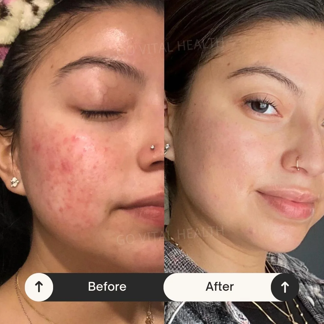 liveon testimonial before and after
